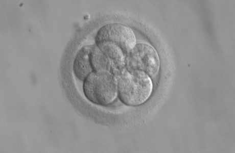 Human embryo 3 days after fertilization